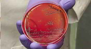 Guinea pig Anti-Islet Cell Antibodies (ICA) ELISA Kit[Anti-Islet Cell Antibodies (ICA)]