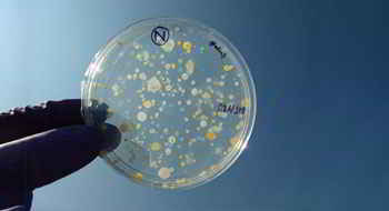 Rat B-Cell Cll/Lymphoma 10 ELISA Kit[B-Cell Cll/Lymphoma 10]