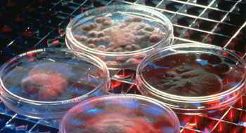 Monkey Anti-Proliferating Cell Nuclear Antigen (PCNA) IgG ELISA kit, 96 tests, Quantitative